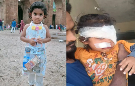 घर के बाहर खेल रही बच्ची को कुत्तों ने बुरी तरह से नोंच डाला, आईसीयू में भर्ती