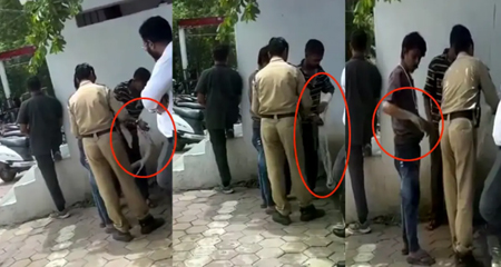 नकली प्लास्टर कांड: डॉक्टर ने कहा- कोई प्लास्टर नहीं लगाया, जांच में कई पुलिसकर्मी घेरे में