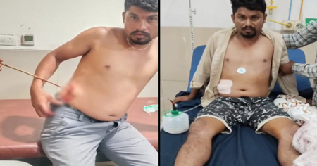 शादी में खूनी संघर्ष: काका ने भतीजे पर चलाया तीर, पेट के अंदर घुसा, रेफर