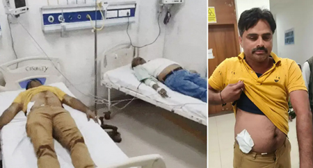 SIR सर्वे टीम पर हमला : नायब तहसीलदार और BLO घायल, तीन हमलावरों पर FIR